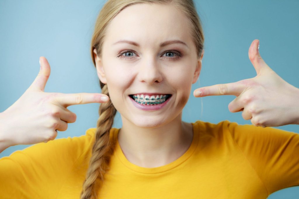 COLORFUL BRACES